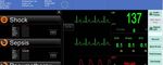 Designing User Interfaces for Smart-Applications for Operating Rooms and Intensive Care Units