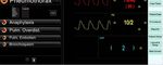 Designing User Interfaces for Smart-Applications for Operating Rooms and Intensive Care Units