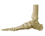 Symalign Allograft Wedge System - Surgical Technique Overview Allograft Osteotomy Wedges - J&J Medical Devices