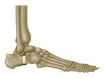 Symalign Allograft Wedge System - Surgical Technique Overview Allograft Osteotomy Wedges - J&J Medical Devices