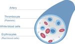 Myelodysplastic Syndromes (MDS) - A Guide for Patients - Leukaemia Care