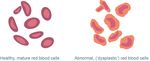 Myelodysplastic Syndromes (MDS) - A Guide for Patients - Leukaemia Care