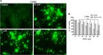 Phenethyl Isothiocyanate Induces Apoptosis Through ROS Generation and Caspase-3 Activation in Cervical Cancer Cells