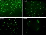 Phenethyl Isothiocyanate Induces Apoptosis Through ROS Generation and Caspase-3 Activation in Cervical Cancer Cells