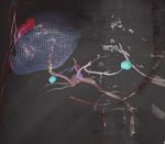Radiology - Department of Radiological ...
