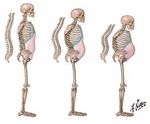GUIDELINES OSTEOPOROSIS - FOR HEALTH PROFESSIONALS - IRISH OSTEOPOROSIS SOCIETY