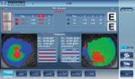 The unique Eye health monitor - Luneau Technology