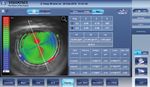 The unique Eye health monitor - Luneau Technology