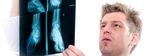 RHEUMATOID Clinical Case: ARTHRITIS - Simple Tasks