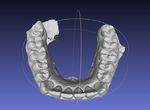 Teleorthodontic treatment with clear aligners: An analysis of outcome in treatment supervised by general practitioners versus orthodontic ...