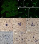 Carbonic Anhydrases: An Ancient Tool in Calcareous Sponge Biomineralization