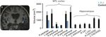 Revisiting the Role of the Medial Temporal Lobe in Motor Learning