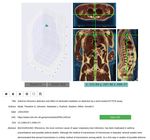 Self-supervised context-aware Covid-19 document exploration through atlas grounding