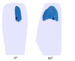 Self-supervised context-aware Covid-19 document exploration through atlas grounding