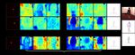 BoneNet: Real-time 3D Human Pose Estimation By Generating Multiple Hypotheses with Bone-map Representation